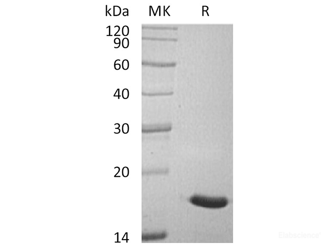Recombinant Human LMW-PTP / ACP1 Protein (C-His)-Elabscience