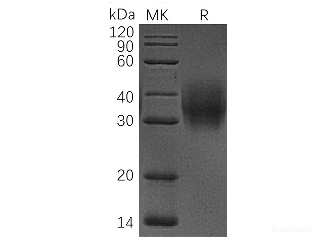 Recombinant Human CD47 / IAP Protein (C-His)-Elabscience