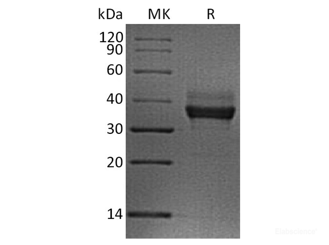 Recombinant Human LILRB4 / CD85k / ILT3 Protein (C-His)-Elabscience