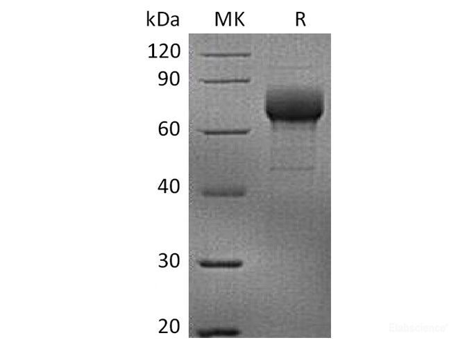 Recombinant Human LILRB4 / CD85k / ILT3 Protein (C-Fc)-Elabscience