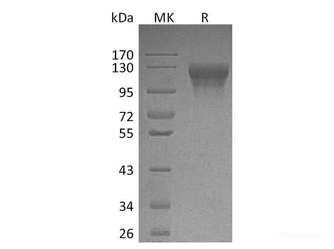 Recombinant Human Leptin Receptor / LEPR / CD295 Protein (C-His)-Elabscience
