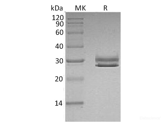 Recombinant Human F11 Receptor / F11R / JAM-A Protein (C-His)-Elabscience