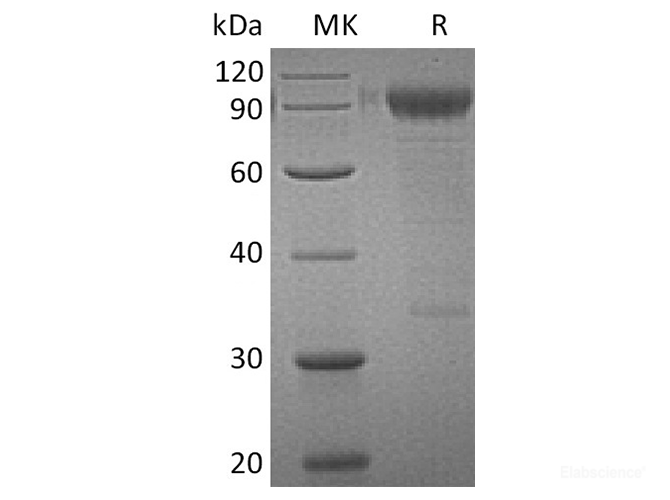 Recombinant Human IL3-RA / CD123 Protein (C-Fc)-Elabscience