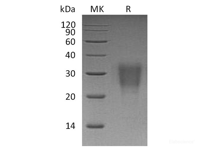 Recombinant Human IL-22 / Interleukin-22 Protein (C-His)-Elabscience