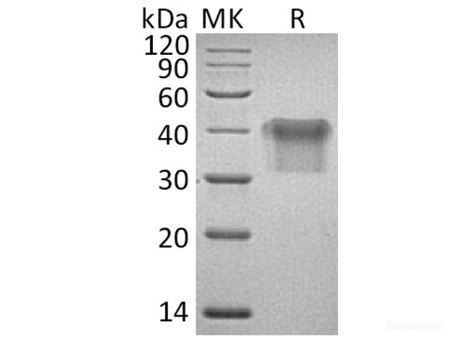Recombinant Human IL2Ra / CD25 Protein (C-His)-Elabscience