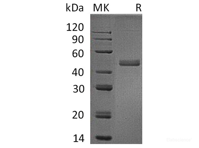 Recombinant Human IL17B / IL-17B Protein (C-Fc)-Elabscience