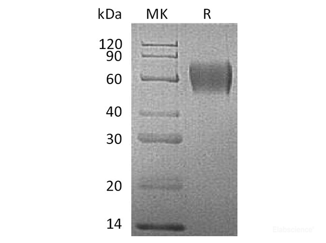 Recombinant Human IL7-RA / CD127 Protein (C-His)-Elabscience