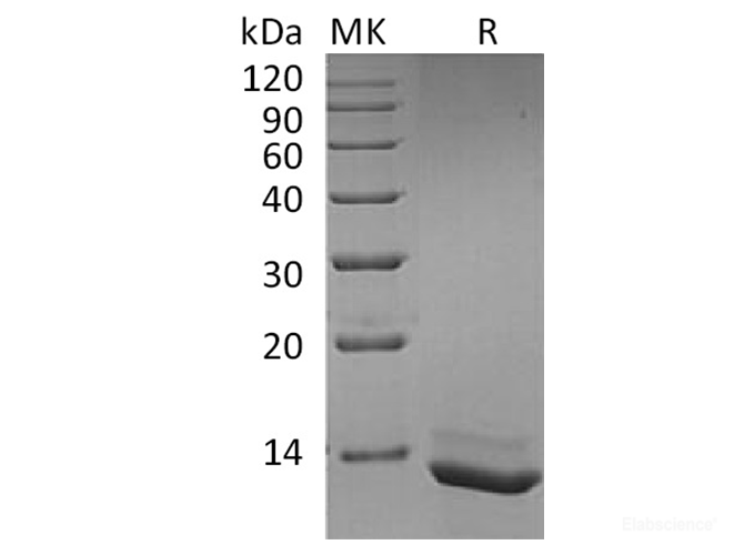 Recombinant Human IL-15 / Interleukin-15 Protein-Elabscience