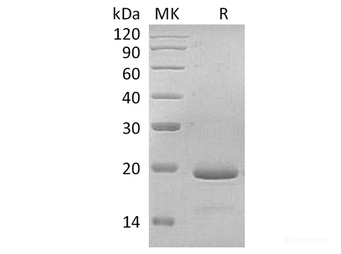 Recombinant Human IL-11 / Interleukin-11 Protein-Elabscience