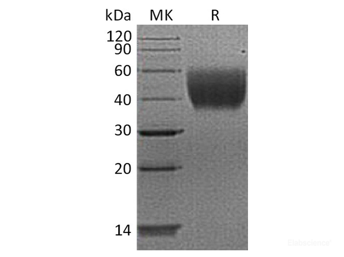 Recombinant Human IL10-RA / IL-10 Rα Protein (C-His)-Elabscience