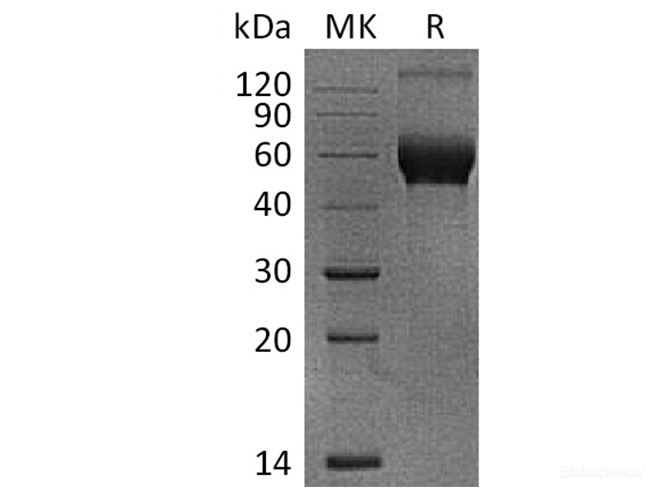 Recombinant Human IL-1R8 / IL1RAPL1 Protein (C-His)-Elabscience
