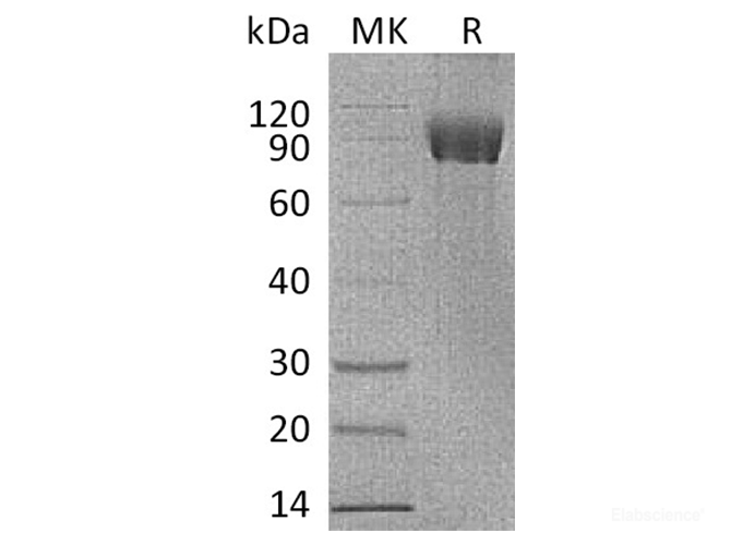 Recombinant Human IL-1R8 / IL1RAPL1 Protein (C-Fc)-Elabscience