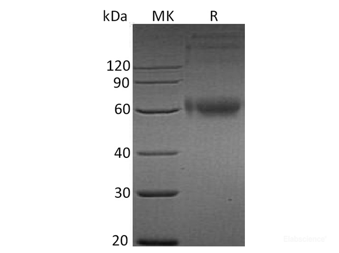Recombinant Human IL-1RAcP / IL1R3 Protein (C-His)-Elabscience