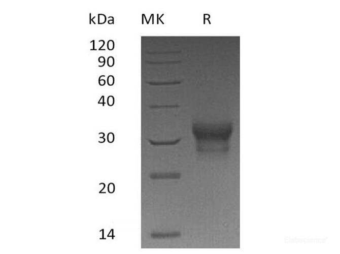 Recombinant Human IFN-λ1 / IL-29 Protein (C-His)-Elabscience