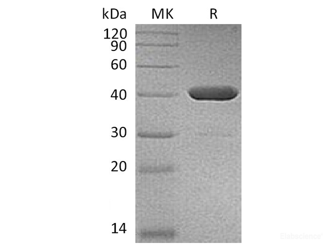 Recombinant Human IDO2 Protein (C-His)-Elabscience
