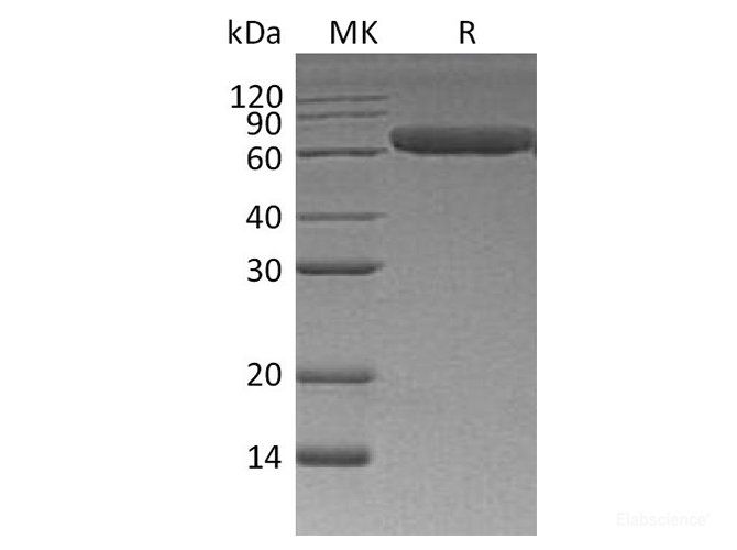 Recombinant Human ROR1 Protein (C-His)-Elabscience