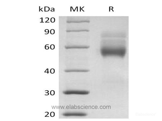 Recombinant Human HVEM / TNFRSF14 Protein (C-mFc)-Elabscience