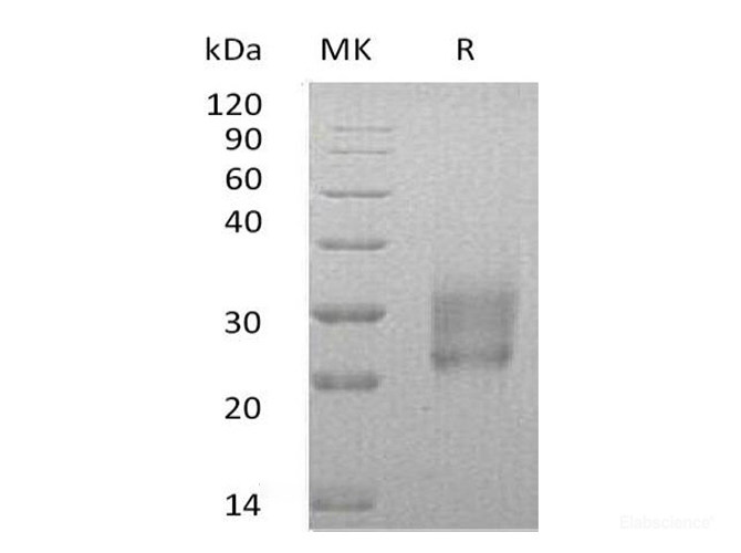 Recombinant Human HAI-2 / SPINT2 Protein (C-His)-Elabscience