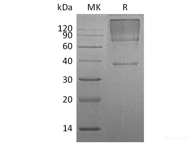 Recombinant Human Glypican 3 / GPC3 / OCI5 Protein (C-His)-Elabscience