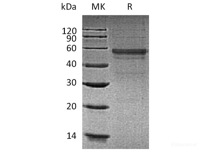 Recombinant Human GLP1R Protein (C-Fc)-Elabscience
