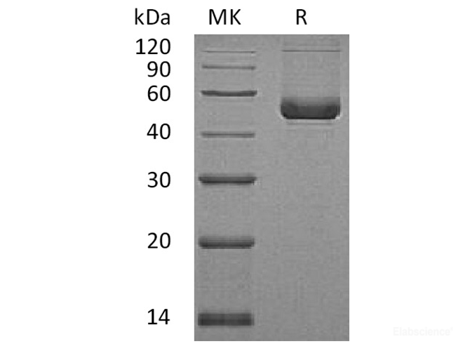 Recombinant Human Serpin E2 / PN1 Protein (C-His)-Elabscience