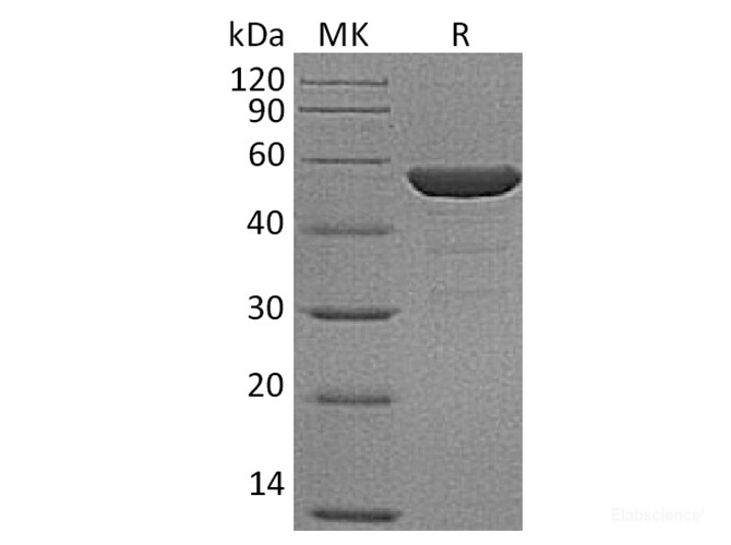 Recombinant Human NSE / ENO2 / Enolase 2 Protein (N-His)-Elabscience