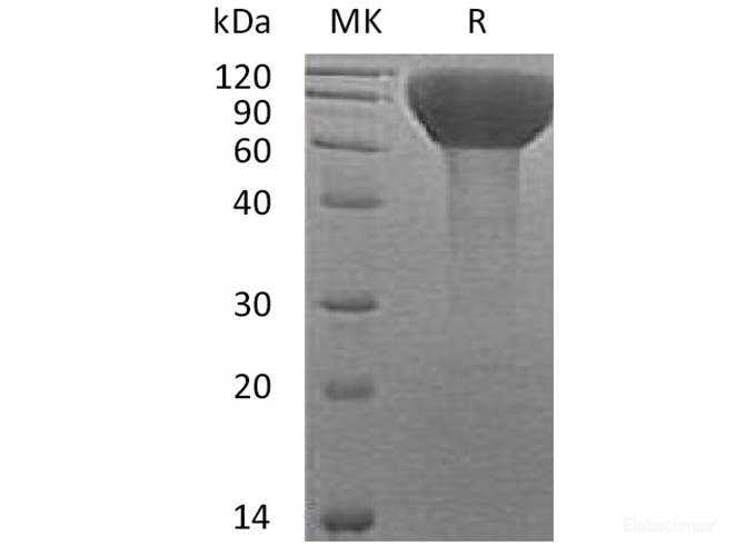 Recombinant Human FLRT3 Protein (C-His)-Elabscience