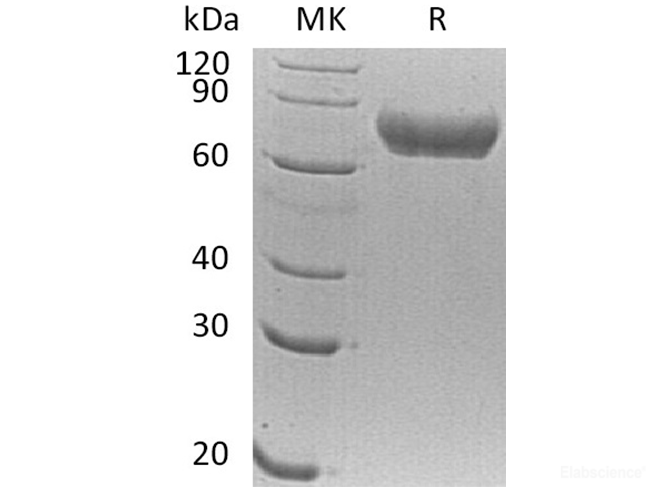 Recombinant Human FLRT1 Protein (C-His)-Elabscience