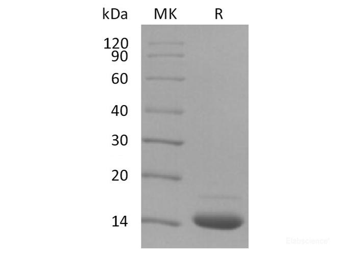 Recombinant Human Fibronectin / Fibronectin Fragment 2 Protein (N-His-Avi)-Elabscience