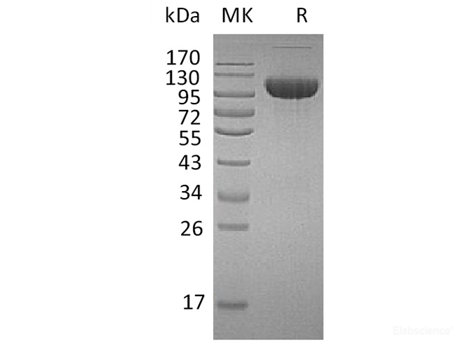 Recombinant Human FGFR3 / CD333 Protein (C-Fc)-Elabscience