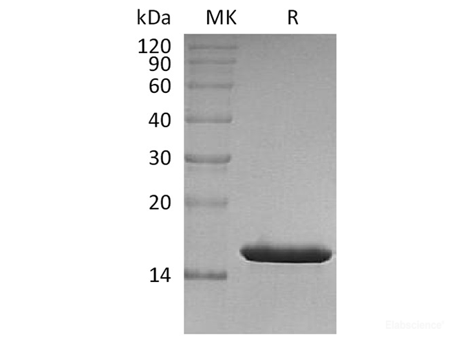 Recombinant Human FABP4 / A-FABP Protein (N-His)-Elabscience