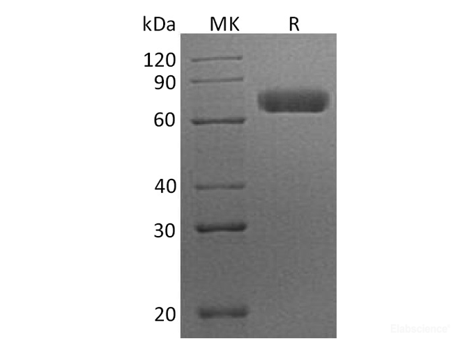 Recombinant Human EphA7 / EHK3 Protein (C-His)-Elabscience