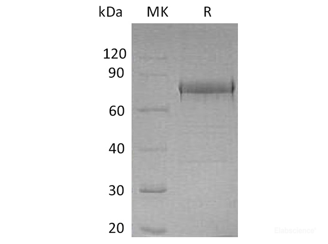 Recombinant Human EphA1 / Eph Receptor A1 Protein (C-His)-Elabscience