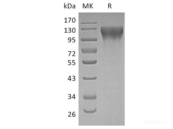 Recombinant Human Endothelin-converting Enzyme 1 / ECE1 Protein (N-His)-Elabscience