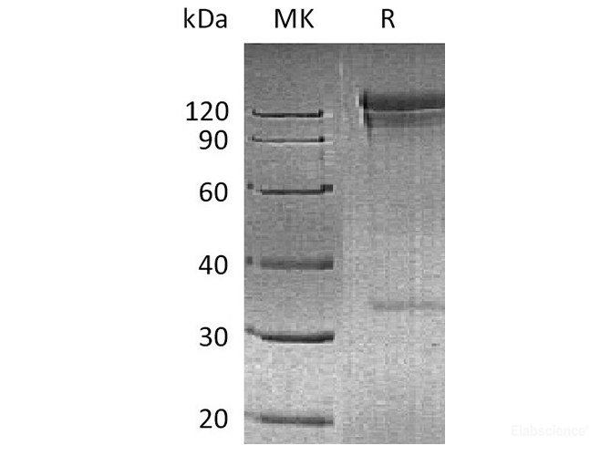 Recombinant Human DPP4 / DPPIV / CD26 Protein (N-Fc)-Elabscience