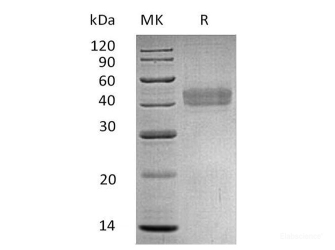 Recombinant Human DKK1 / Dkk-1 Protein (N-His)-Elabscience