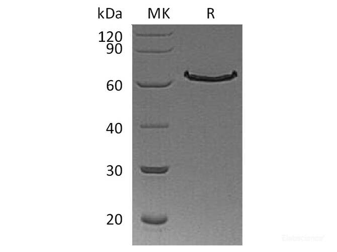 Recombinant Human Delta-like 1 / DLL1 Protein (C-His)-Elabscience