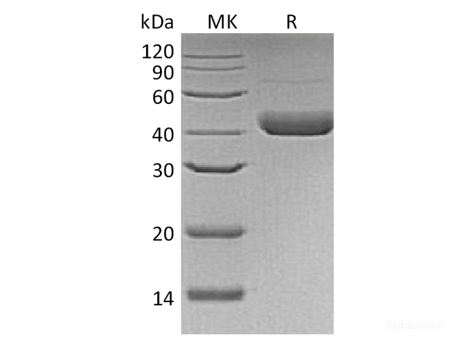Recombinant Human Decorin Protein (C-His)-Elabscience