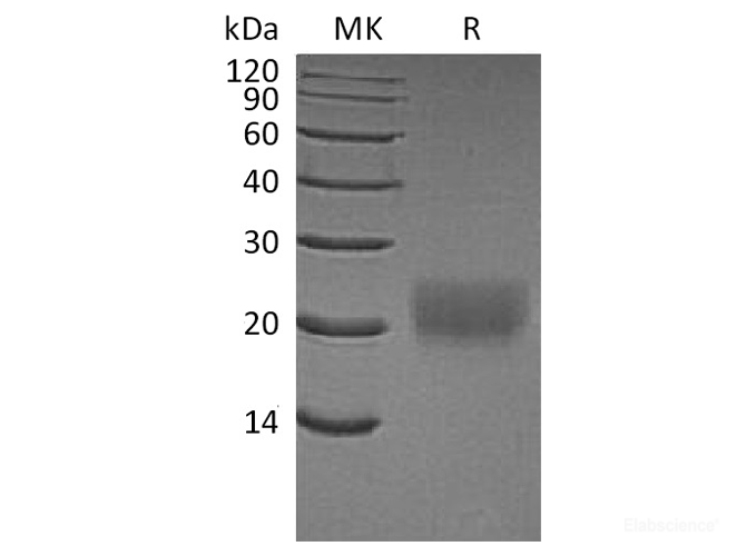 Recombinant Human CTLA4 / CD152 Protein (C-His)-Elabscience