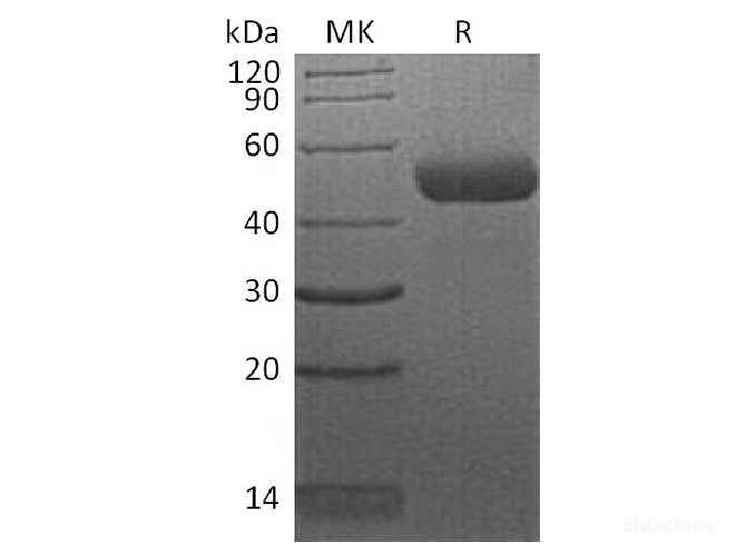 Recombinant Human CTLA4 / CD152 Protein (C-mFc)-Elabscience