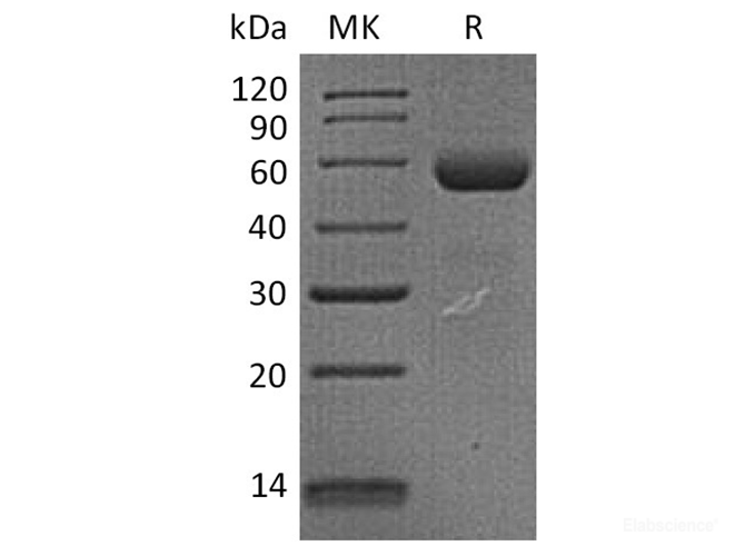 Recombinant Human Dectin-1 Protein (N-Fc)-Elabscience
