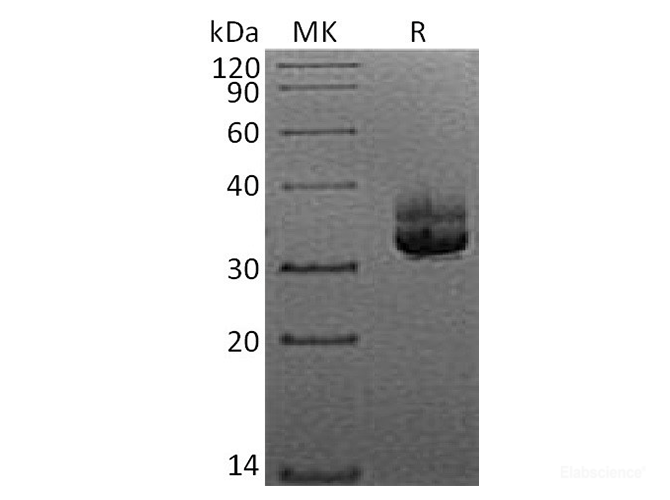 Recombinant Human Langerin / CD207 Protein (N-His)-Elabscience