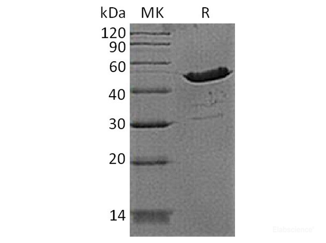 Recombinant Human Creatine Kinase BB / CKB Protein (N-His)-Elabscience