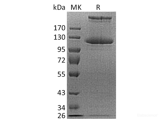 Recombinant Human COL21A1 Protein (C-His)-Elabscience