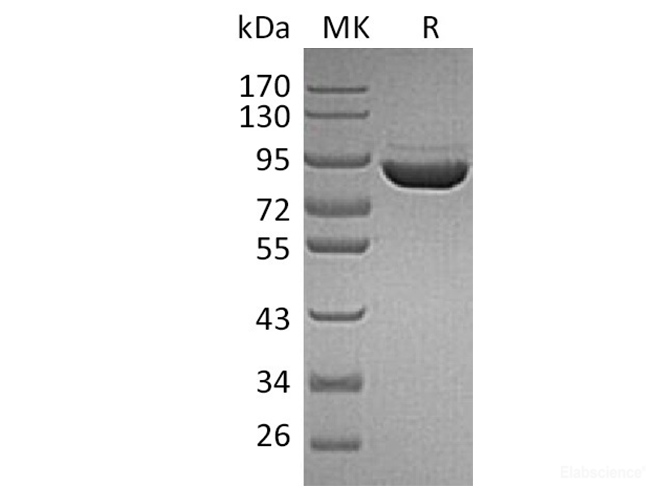 Recombinant Human F13a / Coagulation Factor XIII A Chain Protein (C-His)-Elabscience