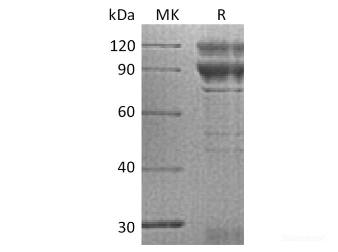 Recombinant Human Coagulation Factor X / F10 Protein (C-Fc)-Elabscience