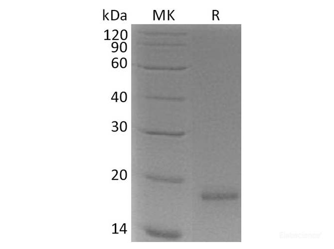 Recombinant Human CLDN18.1 / Claudin-18 / CLDN18 Protein (N-His)-Elabscience