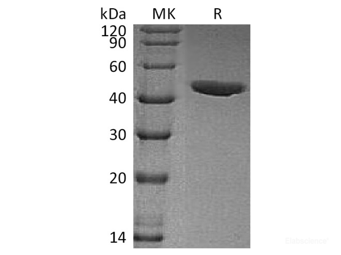 Recombinant Human Chitinase-3-like protein 1 / CHI3L1 Protein (C-His)-Elabscience