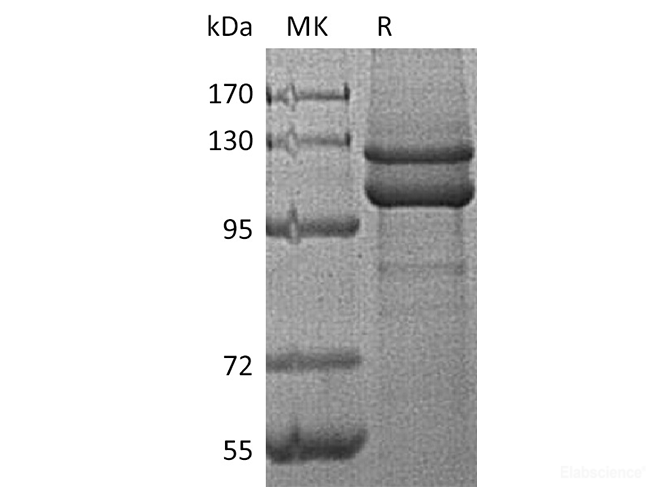 Recombinant Human E-Cadherin / CDH1 / E-cad / CD324 Protein (C-His)-Elabscience
