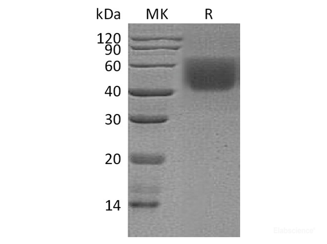 Recombinant Human B7-2 / CD86 Protein (C-His)-Elabscience